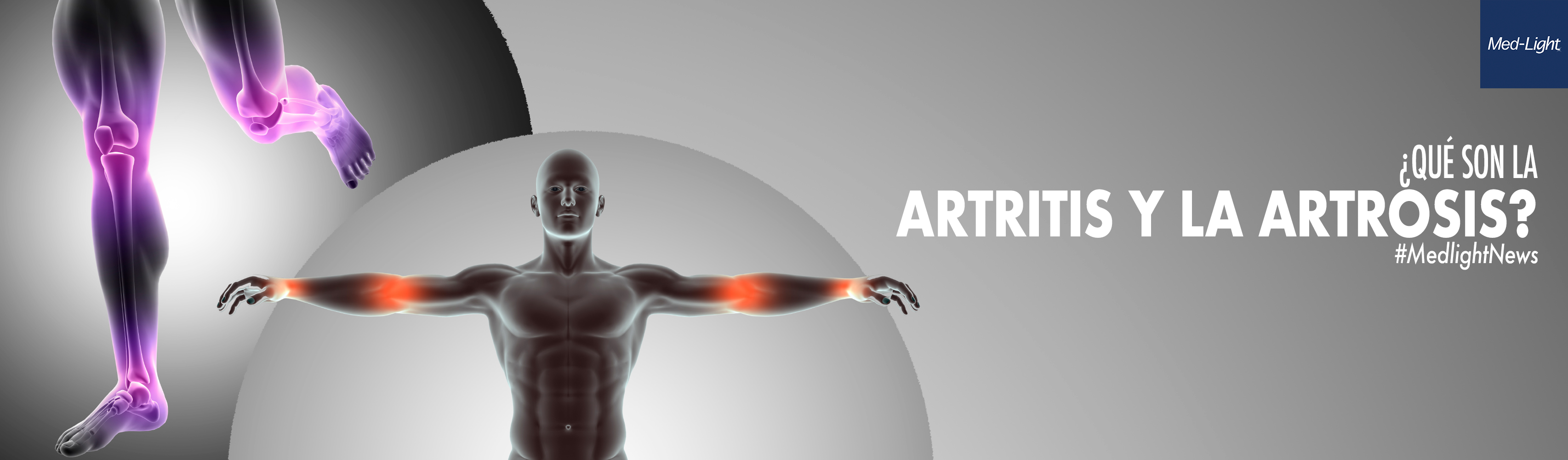 ARTRITIS Y ARTROSIS Blog Medlight Medical
