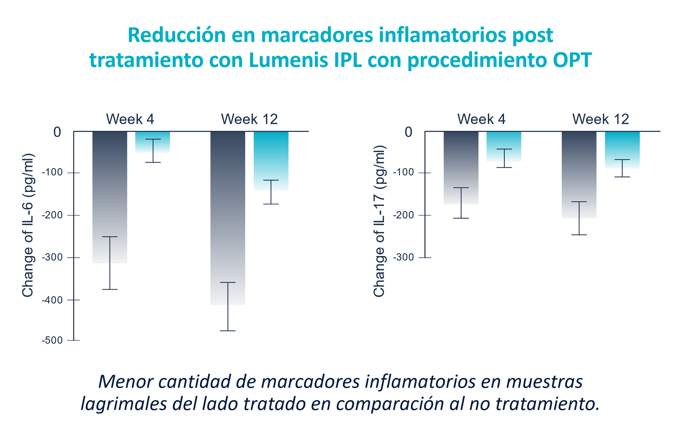 Patented OPT™ Handpiece