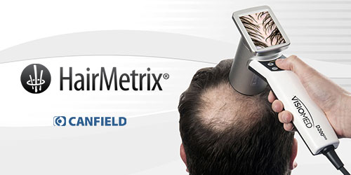 Medlight Medical Canfield HairMetrix